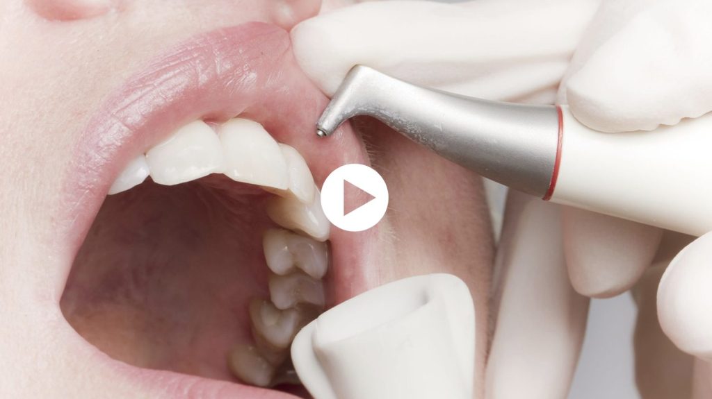 Bildquelle: proDente e.V.